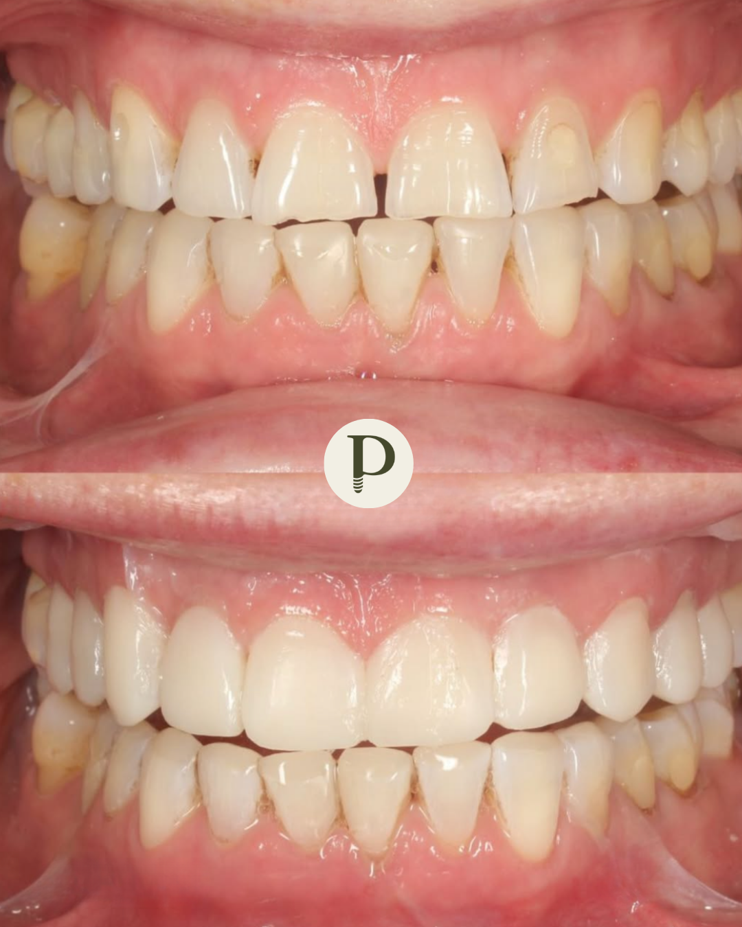Primadent patient smiling after treatment