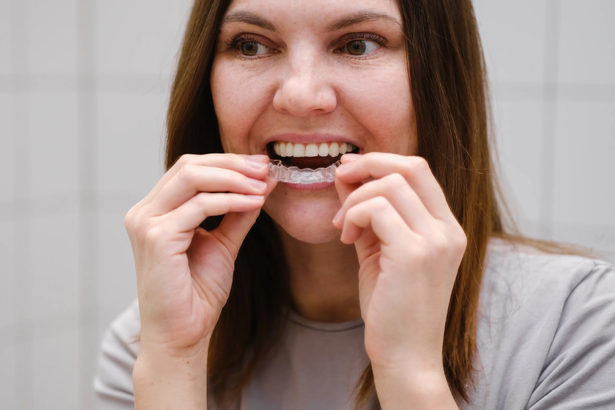 Clear aligners patient at Primadent Liverpool